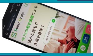 スーパースカルプ発毛センター
